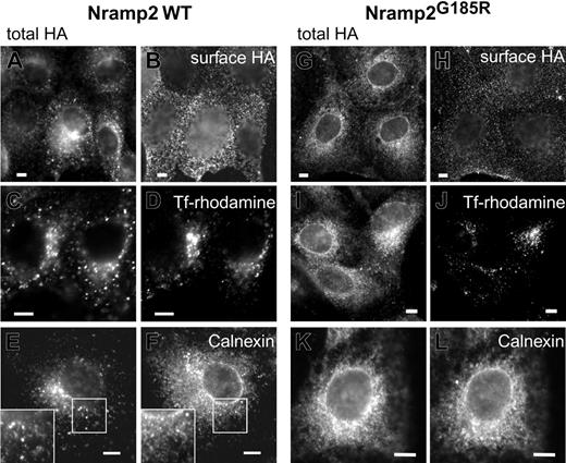 Figure 2. Subcellular distribution of WT and Nramp2G185R. LLC-PK1 cells stably transfected with either WT (A, C, E) or G185R (G, I, K) Nramp2-HA were immunostained with anti-HA antibodies following fixation and permeabilization, to reveal the total cellular Nramp2. The corresponding panels, B, D, F and H, J, L, were stained as follows: B and H, surface Nramp2 was stained selectively by treatment with anti-HA Ab prior to permeabilization, as described in “Materials and methods”; D and J, the cells were incubated with rhodamine-conjugated transferrin for 2 hours prior to fixation to label early endosomes; F and L, permeabilized cells were immunostained with anti-calnexin antibodies. Insets in E and F are magnifications of the indicated areas. Images are representative of at least 3 independent experiments of each type. Scale bars equal 5 μm.