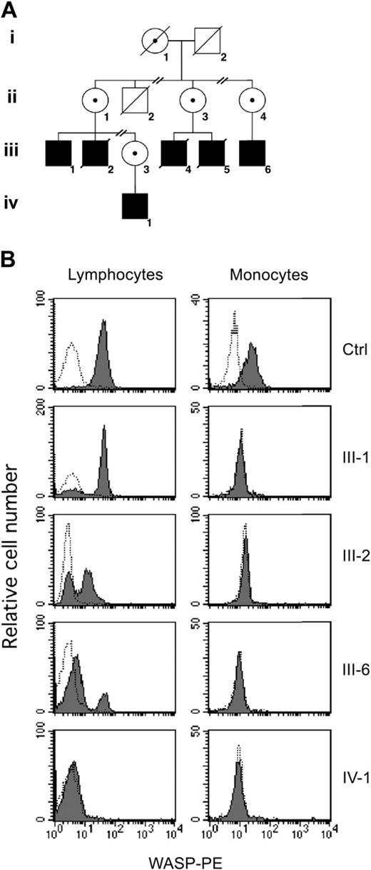 Figure 1. Family tree and analysis of WASP expression. (A) Simplified pedigree of the study family. Solid squares represent affected men; diagonal lines indicate deceased patients. Carrier status in female patients is indicated by a central dot. (B) Flow cytometric analysis of WASP. PBMCs were fixed, permeabilized, and stained with anti-WASP monoclonal antibody (mAb) (solid histogram) or a control antibody (open histogram), followed by phycoerythrin (PE)–conjugated goat antimouse antibody. Shown are the results of WASP expression in lymphocytes and monocytes from a healthy control and from patients III-1, III-2, III-6, and IV-1.