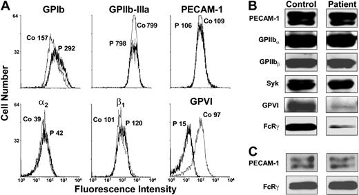 Figure 3. Flow cytometric and Western blot analysis of the GPVI/FcRγ-chain complex. (A) Washed platelets from the patient or from a healthy human donor were incubated for 60 minutes with monoclonal Abs specific for GPIb, GPIIb-IIIa, PECAM-1, integrin α2β1, and GPVI. The median fluorescence intensity is shown near each peak for the patient (P) and a healthy control sample (Co). As shown, the patient expresses 10% to 15% of normal levels of GPVI, whereas other platelet membrane glycoproteins examined are expressed at normal levels. PE-conjugated goat anti–mouse IgG in the presence of an isotype-matched mouse mAb control IgG gave median fluorescence values of approximately 3 arbitrary units (not shown). (B-C) Whole-cell lysates from the patient and a healthy volunteer were subjected to Western blot analysis using the indicated antibodies. Lysates were prepared from either washed platelets (B) or mononuclear cells (C) isolated using Polymorphprep (Axis-Shield, Oslo, Norway). Note that only trace amounts of GPVI and the FcRγ chain are present in patient platelet detergent lysates but that the FcRγ chain is expressed at normal levels in patient mononuclear cells.