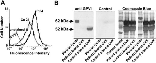 Figure 5. Patient plasma contains an antiplatelet antibody that binds to normal platelets and lacks soluble GPVI. (A) Flow cytometric analysis of patient antiplatelet IgG. Washed normal platelets were incubated with a 1:1 dilution of plasma derived from the patient (P) or a healthy human volunteer (Co) and probed with PE-conjugated goat anti–human IgG Fcγ fragment-specific secondary antibody. Note that patient plasma reactivity is approximately 3 times that of normal plasma. (B) Normal human plasma and patient plasma were incubated overnight with convulxin (CVX)-coated beads. Convulxin-bound proteins were separated on 8% SDS-PAGE, transferred to a PVDF membrane, and probed with cell culture supernatant containing the GPVI-specific mAb 6B12 (anti-GPVI) or media control (Control). Whole platelet lysate (107 human platelets/lane) was added to the first lane of each panel as a control for antibody reactivity and to mark the size of full-length 62-kDa GPVI. Used PVDF membranes were stained with 0.1% Coomassie blue to examine sample loading for normalization. Note that normal human plasma contains a prominent 52-kDa band corresponding to soluble GPVI that is absent from patient plasma.
