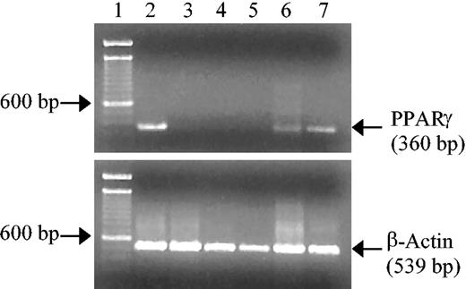 Figure 3. The human megakaryocyte cell line, Meg-01, but not human platelets express PPARγ mRNA. Total RNA was isolated from Meg-01 cells (lane 6) and human platelets (lanes 3-5) and reverse transcribed into cDNA. The cDNA was amplified with primers specific for β-actin (539-bp product, as a control) or PPARγ (360-bp product). A 100-bp ladder was loaded in lane 1. Human adipose tissue (lane 2) and the human monocyte cell line (THP1; lane 7) were used as positive controls. Platelet samples were from a single donor (lane 3) or pooled from several donors (lanes 4-5). Reverse-transcriptase (–) controls were negative in all cases (data not shown).