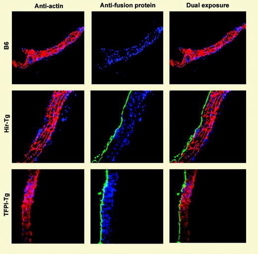 Immunohistology of mouse aortas using antifusion protein mAb (antihirudin for Hir-Tg and antihuman TFPI for TFPI-Tg). See the complete figure in the article beginning on page 1344.
