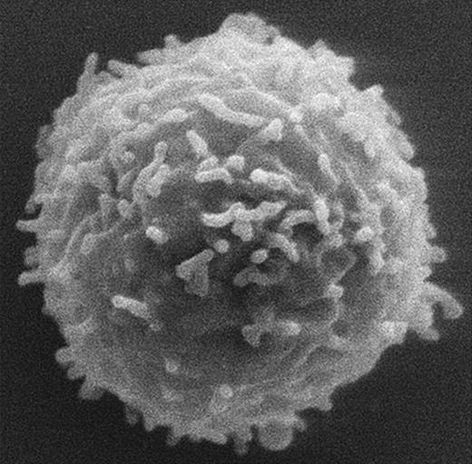 Lymphocytes from WASp knock-out mice have normal microvilli. See the complete figure in the article beginning on page 1396.