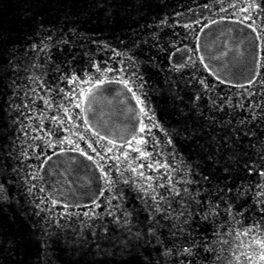 Subcellular distribution of Nramp2G185R. See the complete figure in the article beginning on page 1526.