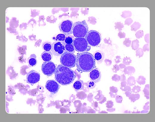 Peter Maslak, Memorial Sloan-Kettering Cancer Center