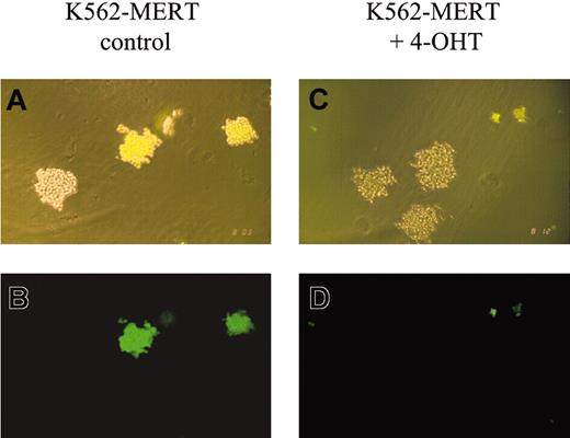 Figure 1. K562-MERT colonies are smaller in the presence of tamoxifen. A mixture of K562 and K562-MERT cells were cultured in methylcellulose in the absence (A-B) and presence (C-D) of 1 μM tamoxifen. After 14 days, the resulting colonies were examined by phase (A,C) and fluorescent (B,D) microscopy using an Olympus IMT-2 microscope (Olympus, Melville, NY), 100 × magnification, 10 ×/0.25 objective lens, 10 × ocular lens, and an Olympus C-35AD-4 camera. The bright and dim colonies in panels A and C contain K562-MERT and K562 cells, respectively.