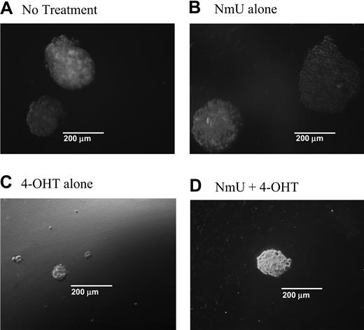 Figure 4. NmU stimulates proliferation in K562-MERT cells. K562-MERT cells were cultured in methylcellulose with GM-CSF and IL-3 (A). In addition, some of the cultures received either 35 mM NmU (B), or 1 mM 4-OHT (C), or both 35 mM NmU and 1 mM 4-OHT (D). Colonies consisting of 20 or more cells were manually counted on day 14 using an Olympus IX 70 microscope at 100 × magnification using a 10 ×/0.3 objective and 10 × ocular and a CoolSnap HQ camera (Photometrics, Tucson, AZ). Representative colonies from 8 independent experiments are shown for each treatment at the same magnification.