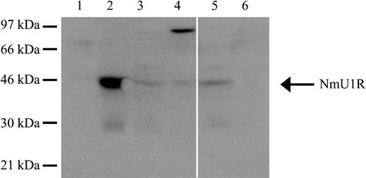 Figure 6. The NmU receptor is expressed in human myeloid cells. The expression of the NMU1R was determined by Western blot analysis. Total protein (50 μg) from HL-60 cells (lane 1), peripheral blood mononuclear cells from a healthy donor (lane 2), K562 cells (lane 3), K562-MERT cells (lane 4), pheresis from a representative AML patient (lane 5), and peripheral blood from a representative ALL patient (lane 6) were fractionated by 10% SDS-PAGE, transferred to a PVDF membrane, and probed with anti-NMU1R. Along the left edge is the position of the protein standards and the arrow points to NMU1R. The solid white line between lanes 4 and 5 denotes the removal of irrelevant sample lanes from the same blot. The blot shown is representative of 3 individual determinations.
