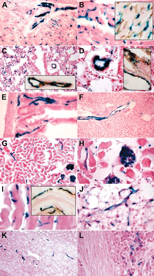 Figure 2. Tamoxifen-induced endothelial recombination in adult organs. LacZ staining and LacZ/CD31 costaining (insets) of organ cryosections derived from end-SCL-Cre-ERT;R26R transgenic mice injected with 2 mg of tamoxifen every 48 hours for 14 days. Sections of the heart showing LacZ-positive endothelium in a sagittally sectioned intramural artery (A) and in capillaries (A-B). CD31+ capillaries also stained for LacZ (B inset). In lung, larger blood vessels and alveolar capillaries stained positive for LacZ (C-D). LacZ-positive lung vessels costained for CD31 (C-D insets). Capillaries of intestinal villi (E) showed LacZ staining. In liver, endothelial cells of the portal tract were LacZ positive, whereas sinusoidal and central venule endothelium is devoid of LacZ staining (F). In kidney (G-H), glomerular and capillary endothelium stained positive for LacZ. Capillaries within striated muscle (I) and fat tissue (J) showed LacZ staining. CD31+ muscle capillaries were also positive for LacZ (I inset). Brain capillaries were LacZ positive (K). A proportion of granule cell neurons within the granule layer of the cerebellum showed a LacZ signal (L). Original magnifications × 10 (F-G), × 20 (A, C, C-D insets, I inset, K), and × 40 (B, B inset, D-E, H-J, L).