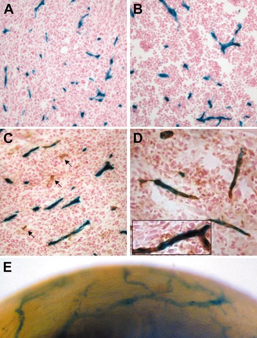 Figure 3. Tamoxifen-inducible endothelial Cre activity during angiogenesis revealed by activation of the R26R allele. Tumor blood vessels stained positive for LacZ: representative histologic sections from a day-14 LLC tumor (A, n = 5) and a day-12 B6RV2 lymphoma (B, n = 4) dissected from adult end-SCL-Cre-ERT;R26R mice. The majority of LLC tumor endothelium costained for LacZ and CD31 (C-D). Arrows point to CD31+ vessels, which did not stain for LacZ (C). A representative CD31+ vessel is shown incorporating LacZ-positive endothelial cells (D inset). Lateral view of end-SCL-Cre-ERT;R26R cornea 12 days after induction of corneal neovascularization (E). Newly formed blood vessels infiltrating the cornea stained positive for LacZ (whole-mount stain). (A-E) Two milligrams of tamoxifen were administered every 48 hours commencing one day before tumor cell implantation or corneal injury, respectively. Original magnifications × 20 (A-C); × 40 (D, D inset).