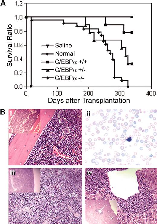 Figure 5. Survival of mice that received transplants with C/EBPα-/- FL cells and host-derived radioprotective cells. (A) C/EBPα+/+, C/EBPα+/-, and C/EBPα-/- FL cells were cotransplanted with host-derived radioprotective cells into lethally irradiated mice at cell doses described in “Materials and methods” and were monitored for survival. Photomicrographs of hematoxylin/eosin-stained sections from BM (i), spleen (iii), and liver (iv), and Giesema-stained peripheral blood smear (ii) of C/EBPα-/- mice are at magnifications of × 400 and insert × 100.