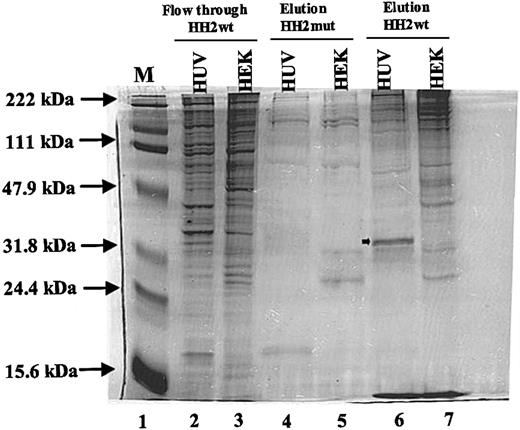Figure 5. Analysis of the nuclear proteins bound to sequences +155 to +184. Nuclear extracts (500 μg) from HUVEC (HUV) and HEK293 (HEK) cells were used in DNA pull-down analyses as described in “Materials and methods.” Lane 1 represents the protein molecular weight marker. Lanes 2 and 3 represent flow-through proteins that were not bound to HH2 wild-type (HH2wt) probe. Lanes 4 and 5 represent eluted proteins bound to HH2 mutant (HH2mut) probe. Lanes 6 and 7 represent eluted proteins bound to HH2wt probe. Arrow in lane 6 represents the endothelial-specific protein. Positions of protein molecular weight markers are shown by arrows.