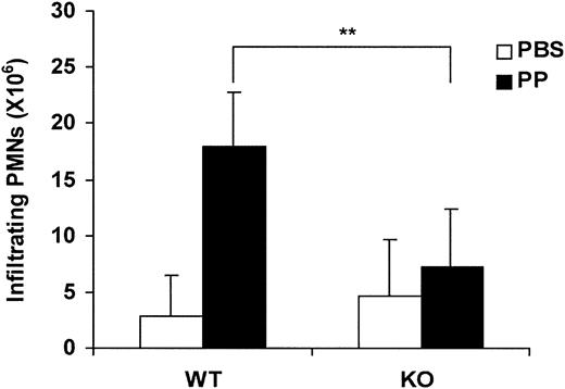Figure 6. Proteose peptone–induced neutrophil accumulation in the peritoneal cavity in wild-type and laminin α4–deficient mice. Harvested neutrophil count in wild-type (WT) and LNα4-deficient (KO) mice treated with either phosphate-buffered saline (PBS) or proteose peptone (PP). Neutrophil peritoneal infiltration was induced by intraperitoneal injection of 3% proteose peptone and measured 6 hours after stimulation. Neutrophils accumulated in the peritoneal cavity were harvested and counted by flow cytometry. There were 8 WT and 8 KO mice analyzed (3 with PBS and 5 with PP for each group). Mean, SD, and P value (**P < .01) are shown. PMN indicates polymorphonuclear neutrophils.