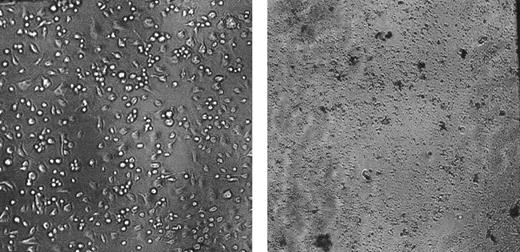 Figure 6. Stromal cells as bystanders. BM cells from CByB6F1 mice treated with 5 Gy TBI and 5 × 106 B6 LN cell infusion 14 days earlier were mixed 1:2 with BM cells from a healthy B6 mouse, and the cell mixtures were then transplanted into new lethally irradiated CByB6F1 recipients. After 2 weeks, BM cells extracted from the recipients were cultured in α-MEM at 33°C with 5% CO2 along with BM cells from 2 fresh CByB6F1 mice to establish stromal feeder layers After 4 weeks in cell culture, fresh BM cells were overlaid on the established feeder layers. Stromal feeder developed from normal CByB6F1 marrow (left) supported marrow cell growth, but stromal cells from cotransplantation recipients could not establish a feeder layer to support marrow growth (right).