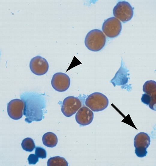 U0126 restores erythroid differentiation in H-ras.V12-transduced erythroid progenitors. See the complete figure in the article beginning on page 1679.