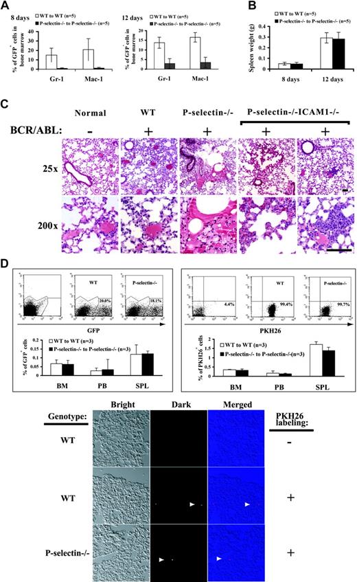 Figure 5. Lack of P-selectin changes the biologic properties of BCR/ABL-expressing myeloid progenitor cells in bone marrow. (A) Lack of P-selectin results in the early release of BCR/ABL-expressing myeloid progenitor cells from bone marrow. Bone marrow cells from wild-type and P-selectin-/- mice that received transplants of BCR/ABL-transduced bone marrow cells were analyzed by FACS at days 8 and 12 after bone marrow transplantation. At both days 8 and 12, the percentage (mean values ± SD) of GFP+/Gr-1+ and GFP+/Mac-1+ cells was significantly higher in bone marrow cells of wild-type CML mice than in those of P-selectin-/- CML mice (P = .007 and .023 for day 8 and P = .039 and .047 for day 12, respectively). (B) Mean spleen weight (mean values ± SD) of the diseased mice at days 8 and 12 after bone marrow transplantation. At both days, there was no significant difference in spleen weight between wild-type and P-selectin-/-/ICAM1-/-CML mice (P = .833 and 0.784 for days 8 and 12, respectively). (C) Pathological analysis (hematoxylin/eosin staining) of the lungs of CML mice (n = 5 for each transplant group) at day 12 after bone marrow transplantation. In the normal control group, nontransduced wild-type bone marrow cells were transplanted into lethally irradiated wild-type recipient mice. In contrast to normal control mice, BCR/ABL-transduced WT to WT, P-selectin-/- to P-selectin-/-, and P-selectin-/-/ICAM1-/- to P-selectin-/-/ICAM1-/- transplant mice showed significant infiltration of the lungs by myeloid leukemic cells. Lung hemorrhages and leukemic cell masses were observed in P-selectin-/- and P-selectin-/-/ICAM1-/-, but not WT CML mice. Scale bars, 100 μM (short bar at 25 ×) and 50 μM (long bar at 200 ×). (D) Lack of P-selectin does not alter the homing properties of the transplanted donor bone marrow cells to bone marrow of the recipient mice. Donor bone marrow cells from wild-type and P-selectin-/- mice were transduced GFP retrovirus, followed by transplantation into wild-type and P-selectin-/- recipient mice, respectively. Prior to the transplantation, the transduced marrow cells were analyzed by FACS for percentage (mean values ± SD) of GFP+ cells (20.0% and 18.1% for the transduced wild-type and P-selectin-/- bone marrow cells, respectively) (top left panel).At 3 hours after the transplantation, cells were isolated from bone marrow, peripheral blood (PB), and spleens (Spl) of the recipient mice, and analyzed by FACS for GFP+ cells. Similar percentages of GFP+ wild-type and P-selectin-/- cells were detected in these locations (P = .86, .86, and .92 for BM, PB, and Spl, respectively). The transduced wild-type and P-selectin-/- donor bone marrow cells were also labeled with a red fluorescent dye PKH26, followed by transplantation into wild-type and P-selectin-/- recipient mice, respectively. Prior to the transplantation, the percentages (mean values ± SD) of PKH26+ cells were 99.4% and 98.7% for wild-type and P-selectin-/- donor cells, respectively (top right panel).At 3 hours after the transplantation, cells were isolated from bone marrow and spleens of the recipient mice and analyzed by FACS for PKH26+ cells. Similar percentages of PKH26+ wild-type and P-selectin-/- cells were detected in these 2 locations (P = .50, .58 and .07 for BM, peripheral blood, and Spl, respectively). Cryosections of the lungs from the mice receiving the PKH26-labeled bone marrow cells were prepared in optimal cutting temperature (OCT) medium, and the labeled cells (arrow heads) on 10-μM sections were visualized under a fluorescent microscope (bottom panel).