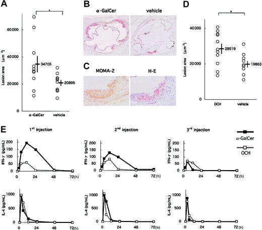 Figure 4. Effects of α-GalCer and OCH on the early phase of atherosclerosis. (A) ApoE-/- mice were intraperitoneally injected 3 times with α-GalCer or the vehicle alone, as described in “Materials and methods.” Five weeks later, mice were examined for the development of atherosclerosis. Each symbol represents the lesion area of an individual mouse. Horizontal bars and numbers represent the mean of all mice within each group, and vertical bars represent SEM. (B) Representative histologic sections of the α-GalCer group and its control group stained with oil red O (original magnification, × 40). (C) Representative immunohistochemical section of the α-GalCer group stained with MOMA-2 and a serial section stained with hematoxylin and eosin (original magnification, × 200). (D) ApoE-/- mice were injected with OCH or vehicle. Mean lesion areas (OCH vs vehicle) are indicated as in Figure 4A. (E) Serum concentration of cytokines after administration of α-GalCer or OCH. Mean concentrations (n = 3) of IFN-γ (top) and IL-4 (bottom) in α-GalCer (▪) and OCH (□) groups are shown after the first injection (left), the second injection (middle) and the third injection (right). Statistical analyses were performed using the Mann-Whitney U test. *P < .05.