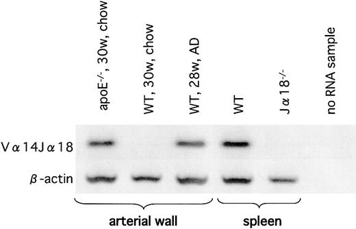 Figure 6. Vα14Jα18 mRNA in the atherosclerotic lesions. Expression of Vα14Jα18 mRNA in the atherosclerotic lesion was examined using RT-PCR. A sample from WT spleen was used as a positive control, and a sample from Jα18-/- spleen was used as a negative control. Note that Vα14Jα18 expression is detected only in the atherosclerotic tissues of apoE-/- mice (on the chow diet) and in WT mice on the AD. Representative result from 3 separate experiments is shown.