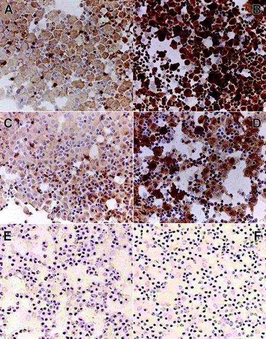 Figure 2. Human DCs express endothelin receptors upon maturation. Immunohistochemical expression of ETA and ETB receptors by immature human dendritic cells (DC), and by DCs stimulated with S aureus (DC + SA). DCs were collected on the seventh day of the culture, either immature or after 48-hour stimulation, and cytospun to the slides. Immunostaining was performed using antibodies against ETA and ETB receptors and the Vectastatin ABC system. Negative controls included staining with irrelevant isotype-matched antibodies. The results from a representative experiment (of 3) are shown. (A) Immature DCs stained with anti-ETA receptor antibodies. (B) Mature DCs (DC + SA) stained with anti-ETA receptor antibodies. (C) Immature DCs stained with anti-ETB receptor antibodies. (D) Mature DCs (DC + SA) stained with anti-ETB receptor antibodies. (E) Negative control: immature DCs stained with isotype-matched irrelevant antibodies. (F) Negative control: mature DCs (DC + SA) stained with isotype-matched irrelevant antibodies. Color was developed with a DAB reagent kit (Biogenex, San Ramon, CA) and slides were counterstained. Microscopy was performed using a Zeiss Axioplan 2 microscope (Carl Zeiss Microimaging, Thornwood, NY) equipped with a digital camera and a 20 ×/0.5 objective (A-D) or a 10 ×/0.5 objective (E,F). Images were acquired using AxioVision KS300 software (Carl Zeiss Microimaging).