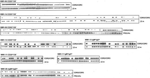 Figure 2. V/D/J sequence designated as clonotypic characterizes phenotypically defined subsets of WM B cells analyzed by single-cell RT-PCR. Clonotypic transcripts were determined by heminested PCR using FR1c/Cμ primers followed by CDR2/CDR3 primers. PCR of β2-microglobulin or FR2/JHc was used as internal control.