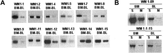 Figure 3. Clonotypic IgM transcripts are detectable in bone marrow and blood of WM patients. Single-stage RT-PCR of unfractionated mononuclear cells prepared from BM and peripheral blood as described in “Patients and methods.” An equal amount of cDNA was used in each sample. Negative control PCR reactions without cDNA or with cDNA from BM or blood of healthy controls (n = 2) or unrelated WM patients (n = 8) lacked bands. Water controls were negative. Amplification was performed using (A) CDR2 (patient specific) and CDR3 (patient specific) primers or (B) CDR3R (patient specific) and CμS (S) or CμM (M) primers.