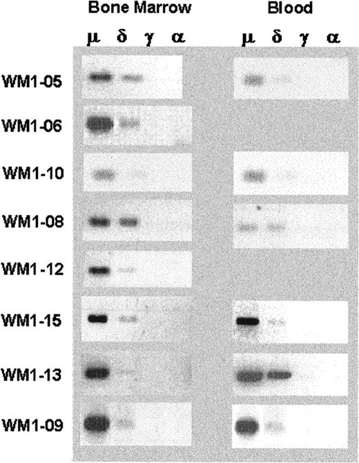Figure 5. Lack of class switching in B cells from bone marrow and peripheral blood of WM patients. RT-PCR of unfractionated mononuclear cells prepared from BM and peripheral blood of WM patients as described in “Patients and methods.” An equal amount of cDNA was used in each sample. Amplification was performed using CDR3R (patient specific) and respective CH1 primers. Negative controls of PCR reaction without cDNA or with cDNA from BM or blood of healthy controls (n = 2), or other WM patients (n = 8) did not yield any bands.