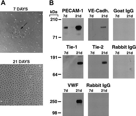 Figure 1. Differentiation of cord blood–derived CD34+ cells into endothelial cells. (A) Phase contrast photomicrograph of cord blood CD34+ cells at 7 and 21 days of culture. At 7 days, the formation of small colonies of adherent cells (arrow) is observed, and by 21 days a confluent endothelial-like monolayer has formed. (B) Western blotting of cell lysates (5 μg total protein/lane) from cord blood CD34+ cells at 7 and 21 days of culture probed with anti–PECAM-1, VE-cadherin, Tie-1, Tie-2, VWF antibodies, and the appropriate control species IgGs.