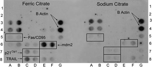 Figure 1. Iron induces mdm2 gene expression by normal human synovial cells. Following incubation in the presence or absence of ferric citrate (1 mM) or the same concentration of sodium citrate for 9 days, RNA was isolated from normal human synovial cells and probed using a microarray (GEArray no. 9 905 020; SuperArray. The left membrane demonstrates the pattern of gene expression in cells cultured with ferric citrate, and the right membrane shows the pattern following exposure to sodium citrate. This experiment was repeated with similar results and consistent induction of these genes was observed.