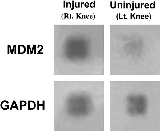 Figure 3. Hemarthrosis induces mdm2 expression in mouse synovium. Synovial tissue was isolated from the right and left knee joints of 10 hemophilic mice and the RNA isolated then pooled and probed using a gene expression microarray assay. The expression of mdm2 and GAPDH are shown in tissue from the injured (right) and uninjured (left) control joints. This experiment was repeated with similar changes in mdm2 gene expression.