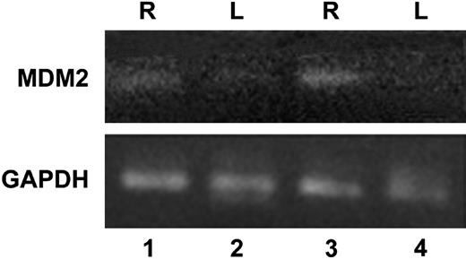 Figure 4. Expression of mdm2 by synovial cells using RT-PCR. Synovial tissue was isolated as described for Figure 3. RNA was used in RT-PCR with primers for mdm2 and GAPDH. RNA from tissue from the right (R, lanes 1 and 3) and left (L, lanes 2 and 4) knee joints after one (lanes 1 and 2) or 2 (lanes 3 and 4) episodes of hemarthrosis are shown. Similar results were obtained when tissue from day 3 or day 10 was analyzed. This experiment was repeated twice with similar results.