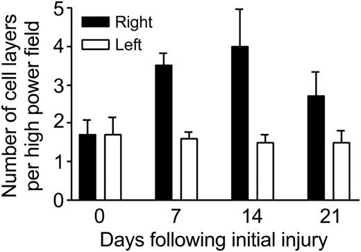 Figure 5. Hemarthrosis increases synovial cell proliferation. The right knees of hemophilic mice were subjected to a controlled blunt trauma to induce hemarthrosis. The animals were killed on day 7 after the initial injury, on day 14 after 2 injuries on days 0 and 7, or on day 21 after 3 injuries on days 0, 7, and 14 to simulate recurrent target joint bleeding. Equatorial histologic sections through the knee joints were prepared and examined by light microscopy. Five areas of the synovial membrane were chosen randomly and the number of synovial cell layers counted by 4 independent observers blinded to the experimental conditions. The results were pooled and the average and standard deviation (shown by error bars) calculated. Student t test was used to compare the differences between groups.