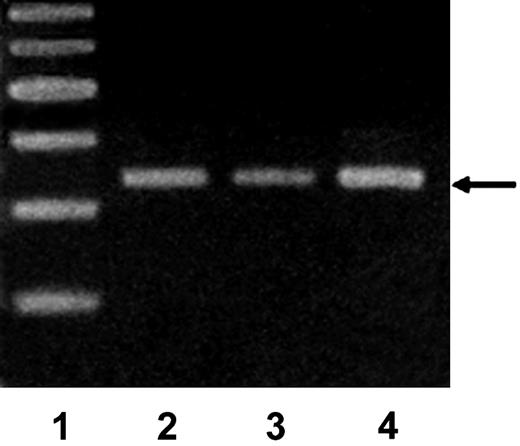Figure 6. Iron increases the expression of mdm2 by murine synovial cells. Normal murine synovial cells were cultured in the presence of iron citrate (10 μM) for 7 days after which RNA was isolated, subjected to RT-PCR, and then analyzed by gel electrophoresis with ethidium bromide and photographed under UV transillumination. Lane 1, markers; lane 2, control synovial cells maintained in standard culture medium without added salt; lane 3, synovial cells exposed to sodium citrate; lane 4, cells cultured in the presence of 10 μM ferric citrate for 7 days. Arrow indicates mdm2. Data shown are representative of 6 total experiments performed.