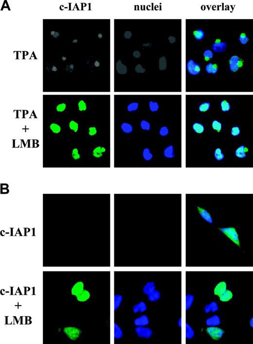 Figure 3. c-IAP1 redistribution involves a leptomycin B-sensitive mechanism. (A) Fluorescence microscopy analysis of c-IAP1 expression (Pharmingen mAb; green) in THP1 cells treated with 20 nM TPA for 24 hours in the presence or absence of 100 nM leptomycin B (LMB). Hoechst 33342 was used to stain the nuclei (blue). (B) HeLa cells were transiently transfected with a GFP-c-IAP1 construct before staining the nuclei with Hoechst 33342 and fluorescence microscopy analysis. When indicated, LMB (200 nM) was added 3 hours before analysis. Magnification is × 500 for panels A and B.