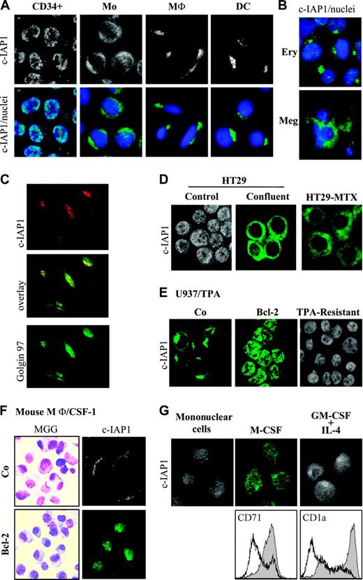 Figure 7. c-IAP1 redistribution is a differentiation-associated event in various cell types. (A) Fluorescence microscopy analysis of c-IAP1 (mAb; Pharmingen) in peripheral blood CD34+ cells and monocytes (Mo) obtained from healthy donors and in macrophages (MΦ) and dendritic cells (DC) obtained from monocytes cultured for 6 days in the presence of M-CSF or GM-CSF/IL-4, respectively. The top panels show c-IAP1 alone (green); the bottom panels, c-IAP1 (green) + Hoechst 33352-labeled nuclei (blue). (B) Fluorescence microscopy analysis of c-IAP1 (mAb; Pharmingen; green) in CD34+ cell-derived erythoblasts (Ery) and megakaryocytes (Meg). Nuclei were labeled simultaneously with Hoechst 33352. (C) Colocalization of Golgin 97 (green) and c-IAP1 (red) in macrophages derived from peripheral blood monocytes as described for panel A. (D) Fluorescence microscopy analysis of c-IAP1 (pAb; Santa Cruz Biotechnology) in HT29 cells studied before (control) and after (confluent) reaching confluence in culture and in a methotrexate-resistant, well-differentiated derivative cell clone (HT29-MTX). (E) Fluorescence microscopy analysis of c-IAP1 (pAb; Santa Cruz Biotechnology) in control (Co), Bcl-2-overexpressing (Bcl-2), and TPA-resistant U937 cells exposed for 72 hours to 20 nM TPA. (F) May-Grünwald-Giemsa staining (MGG) and fluorescence microscopy analysis of c-IAP1 (pAb; Santa Cruz Biotechnology; Bcl-2) in bone marrow monocytes from control (Co) and Bcl-2 transgenic (Bcl-2) mice, cultured for 3 days in the presence of CSF-1-containing medium. (G) Peripheral blood mononuclear cells obtained from patients with chronic myelomonocytic leukemia (CMML) were cultured for 6 days in the presence of M-CSF or GM-CSF/IL-4. The top panels show fluorescence microscopy analysis of c-IAP1; the bottom panels, flow cytometry analysis of CD71 and CD1a membrane expression. White histograms indicate CMML patient; and gray histograms, healthy donor. One representative of 7 studied patients is shown. Magnification: × 700 (A-C, E, G) and × 500 (D, F).