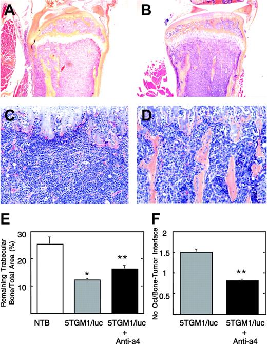 Figure 5. Histological view of tibia of untreated and anti-α4 Ab-treated 5TGM1/luc-bearing mice. Note that the bone marrow cavity is occupied by 5TGM1/luc myeloma cells, and no trabecular bones are seen in the untreated group (A, C). On the other hand, normal marrow elements and trabecular bones are still observed in the anti-α4 Ab-treated group (B, D). Slides were examined using an Olympus BX-40F4 microscope equipped with a film camera (Olympus, Melville, NY). Panels A and B: lower magnification (H-E, × 40); panels C and D: higher magnification (H-E, × 200). Histomorphometric analysis of remaining trabecular bone/total area (E) and osteoclast number at the interface between myeloma and bone (F). Data are mean ± SEM (n = 5). *Significantly different from non-tumor-bearing (NTB) mice. **Significantly different from untreated 5TGM1/luc-bearing mice.