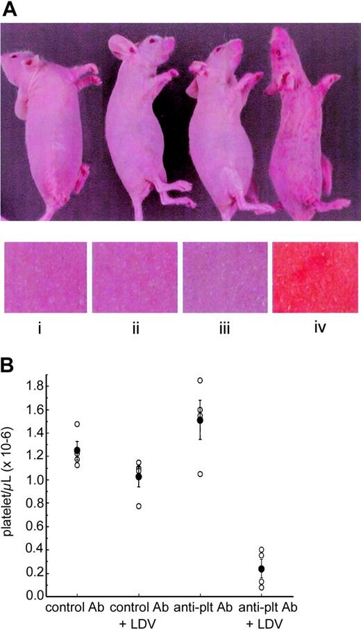 Figure 2. Thrombocytopenic purpura induced by LDV infection in nude mice. (A) Global clinical picture and skin detail of BALB/c nu/nu mice 1 day after administration of IgG from polyclonal anti-mouse platelet rabbit serum (anti-plt Ab) (3 μg; iii-iv) or control rabbit IgG (i-ii) and of LDV (ii, iv) or saline (i, iii). Photographs were taken with a Nikon Coolpix 4500 (Nikon, Tokyo, Japan). (B) IgG (3 μg) from polyclonal anti-mouse platelet rabbit serum or control rabbit IgG was injected into groups of 4 BALB/c nu/nu mice with LDV infection or administration of saline. Platelets were counted 2 days later (○ represents each individual datum; •, means ± SEM). Panels A and B represent independent experiments.
