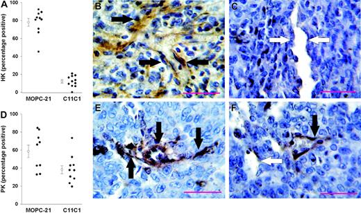 Figure 7. Percentage of vessel immunopositivity to HK and PK. HK results are on the top, PK results on the bottom. (A) Percentage of tumor vessels (entire endothelial cell layer) immunopositive to anti-HK in animals treated with MOPC-21 and mAb C11C1. There was a dramatic and significant decrease in the percentage of vessels positive for HK in the C11C1-treated group. (B) Representative microphotograph (cell at × 730) from animals treated with MOPC-21 showing endothelial cells staining brown (black arrows). (C) Representative microphotograph from animals treated with mAb C11C1; most vessels were immunonegative for HK. White arrows point to immunonegative endothelial cells. (D) Percentage of tumor vessels immunopositive to anti-PK in animals treated with MOPC-21 and mAb C11C1. There was a significant decrease in PK immunopositivity in the animals treated with mAb C11C1. (E) Representative microphotograph from animals treated with MOPC-21 showing endothelial cells with brown staining (black arrows). (F) Representative microphotograph from animals treated with mAb C11C1. Thirty-eight percent of the vessels examined were immunopositive to PK. The black arrow points to a positive vessel and the white arrow points to a negative vessel. The red bars in panels B, C, E, and F indicate 100 μM. The open circles in panels A and D are the mean ± SEM.
