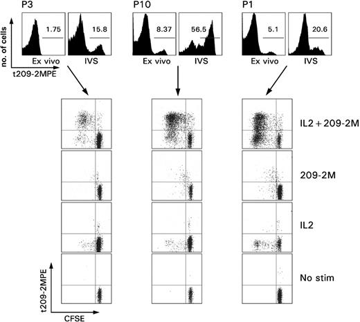 Figure 1. Proliferative ability of immunization induced CD8+ T cells. PBMCs from 3 patients with melanoma underwent in vitro sensitization (IVS) with 1 μM 209-2M followed by a 7-day culture in IL-2 (300 IU/mL). The top panel shows the proportional expansion of tHLA+ T cells during IVS. The numbers in the histograms, as gated by the horizontal bars, represent the Tc-pf as percent of tHLA+ over CD8+CD3+ T cells. The rows depict the proliferative capacity of the same samples under usual IVS conditions (IL-2 + 209-2M), or when only antigen recall (209-2M), IL-2, or neither (no stimulation) was applied. Proliferation is presented as decreases in CFSE fluorescence proportional to number of cell divisions.