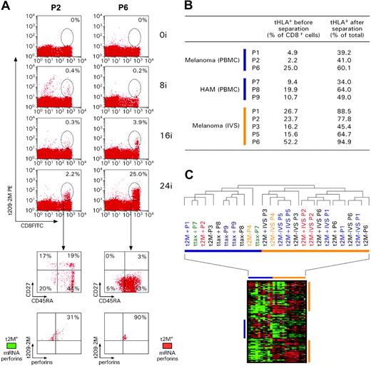 Figure 3. Transcriptional differences between circulating and IVS CD8+ T cells. (A) Kinetics of response to repeated subcutaneous immunizations with 209-2M. PBMCs obtained before treatment and 3 weeks after 8, 16, and 24 immunizations were simultaneously thawed and tested. Staining was performed with FITC-conjugated anti-CD8 mAb and PE-labeled tHLA/209-2M. In each experiment 200 000 events were analyzed per sample. The first column shows patient 2 (P2) as representative of most patients; the second column portrays the unusual case of patient 6 (P6). T-cell precursor frequency is presented as percent of CD8+ T cells in each histogram. The lower panels show the expression of CD45RA and CD27 or tHLA/209-2M and perforin in the 24i samples from the 2 patients. In addition, the level of perforin mRNA expression is shown in color code (green less than and red more than the average expression of perforin mRNA in pooled PBMCs). (B) Enrichment of 209-2M– or Tax-specific CD8+ T cells from PBMCs or IVS. In all experiments, the purity of tHLA– CD8+ T cells was above 95%. (C) Eisen hierarchical clustering of all samples applied to a data set of 7580 genes allowed by high-stringency filtering (Cy5/Cy3 ratios with at least a 3-fold change, signal intensity > 500 unless the other channel > 3000 in at least 80% of the sample tested). Samples from individual patients are color coded. 2M indicates 209-2M–specific T cells from patients with melanoma; tax, HTLV-1 Tax-specific T cells from patients with HAM; +, tHLA positive; –, tHLA negative. Horizontal bars underline clusters enriched with circulating (blue) and IVS (orange) CD8+ T cells. Blue and orange vertical bars underline functional signatures specific for the 2 respective clusters.