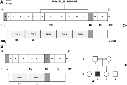 Figure 1. A large in-frame deletion in IL12RB1. (A) Schematic representation of the wild-type IL-12Rβ1 chain containing 17 coding exons (Arabic numerals) encoding 662 amino acids, with a peptide leader sequence (L), extracellular domain (exons 2 to 13, EC), transmembrane domain (exon 14, TM), and an intracellular, cytoplasmic domain (exons 15 to 17, IC). The mutation found in P is also indicated (700 + 362_1619-944 del). The mature IL-12Rβ1 chain contains 5 fibronectin III (FNIII) domains shown in the bottom row in light gray. (B) Schematic representation of the mutant protein, lacking the sequences encoded by 6 of the exons (8 to 13) in the wild-type gene. The mutant protein contains 356 amino acids and only the first 2 FNIII domains of the extracellular domain but has intact transmembrane and intracellular domains. In the family tree, the patient is indicated by an arrow.