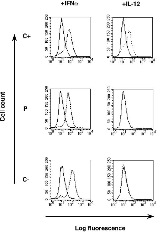 Figure 3. Lack of phosphorylated STAT4 upon IL-12 stimulation, as shown by FACS analysis. PHA-T-cell blasts from a positive control (C+), a negative control (C-), and the patient (P) were left unstimulated (plain line) or were stimulated (dotted line) with IFN-α (105 U/mL) (left) for 30 minutes or with IL-12 (100 ng/mL) (right) for 15 minutes. Cells were fixed by PFA and methanol, permeabilized with saponin, and stained with a phospho-STAT4 rabbit polyclonal Ab (Zymed) (or matched isotype control), followed by goat anti-rabbit Alexa Fluor 488 (Molecular Probes).