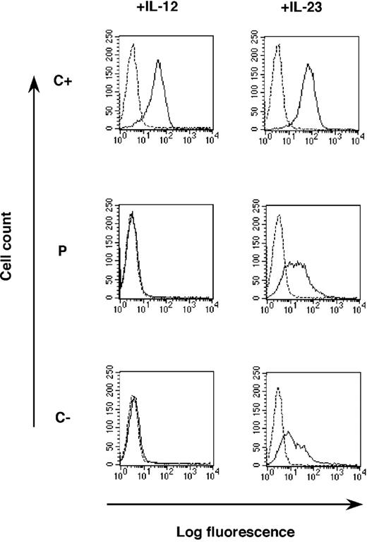 Figure 5. Lack of cytokine binding to the surface of PHA-T-cell blasts. PHA-T-cell blasts from a positive control (C+), a negative control (C-), and the patient (P) were incubated without (dotted line) or with (plain line) IL-12p70 or IL-23 for 30 minutes at 4°C. The PHA-T-cell blasts were then incubated with a purified mouse anti-IL-12 p40 antibody, followed by a biotinylated anti-mouse antibody, and antibody binding was detected by incubation with PE-conjugated streptavidin.