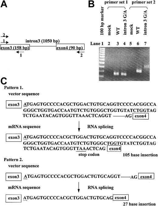 Figure 2. The effect of the intron 3 G→A mutation on RNA splicing. To evaluate the effect of the intron 3 G→A mutation on RNA splicing, we transfected minigene expression vectors into HEK293 cells. Total RNA was purified, which was subjected to RT-PCR analysis. (A) Primer sets for the PCR analysis are shown. Set 1 amplified exon 3 (158 bp), whereas set 2 amplified exon 3 and exon 4 (248 bp). (B) Results of RT-PCR. Primer set 2 yielded the 248-bp band from WT-transfected cells (lane 6), and primer set 2 yielded different products from intron 3 G→A mutant-transfected cells (lane 7). (C) Sequence analysis of the transcript from intron 3 G→A mutant-transfected cells. Underlines indicate the position of the G→A mutation. Forty-nine clones were analyzed: 38 clones had a 105-bp insert, and 11 clones had a 27-bp insert. Each variant was spliced with recognition at the GT-AG motif.