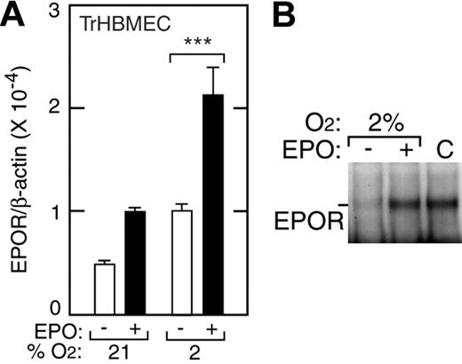 Figure 1. Induction of EPOR by hypoxia in TrHBMECs. (A) EPOR expression was determined by quantitative real-time RT-PCR in TrHBMECs at 21% and 2% O2 without (□) and with (▪) EPO (5 U/mL). Compared with the EPOR level in 21% O2, we observed a 5-fold maximal induction of the EPOR after 48 hours of treatment with EPO at 2% oxygen (***P < .001). Results were normalized to β-actin expression. (B) Western blotting confirmed EPO induction of EPOR protein for cells cultured at 2% O2 for 48 hours. Error bars represent SD.