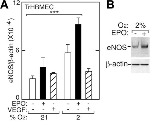 Figure 2. Induction of eNOS by EPO in TrHBMECs. (A) eNOS expression was determined by quantitative real-time RT-PCR without (□) or with (▪) EPO (5 U/mL) or VEGF (5 pg/mL; ▨) at 21% O2 and 2% O2 for 48 hours. eNOS expression was induced following treatment with EPO at 2% O2 compared with expression at 21% (***P < .001) but was not induced following treatment with VEGF. Results were normalized to β-actin expression. (B) Western blotting confirmed greater induction of eNOS protein in cells cultured for 24 hours at 2% O2 in the presence of EPO. Error bars represent SD.