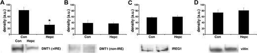 Figure 1. Effects of hepcidin on iron transporter protein expression. Iron transporter protein expression was determined by Western blotting of total plasma membrane fractions isolated from Caco-2 TC7 cells. Following exposure to hepcidin, DMT1 (+IRE) protein was significantly decreased (*P < .01, Student unpaired t test), whereas DMT1 (non-IRE) (P > .2) and IREG1 (P > .2) protein expression was unaltered. Densitometry data are means ± SEM of 3 to 4 observations in each group and are accompanied by representative bands for each protein studied.