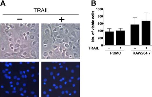 Figure 4. Lack of cytotoxic effects of TRAIL on osteoclastic precursors. Adherent PBMCs and RAW264.7 cells were cultured in the absence or presence of TRAIL. (A) PBMCs were let to adhere for 3 days and then were exposed to TRAIL for 48 hours. Cultures were examined for apoptosis and cell viability by light microscopy (top panels) and by DAPI staining and fluorescence microscopy (bottom panels). Shown are single fields that are representative of untreated and TRAIL-treated cultures. Original magnification, × 20. (B) The number of viable cells was scored in at least 6 random fields at × 10 magnification of PBMCs and RAW264.7 cells after 12 days of culture. Data represent the means ± SD of 7 different experiments for each cell system.