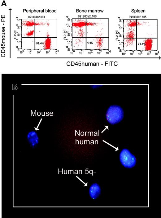 Figure 1. Human MDS marrow cells in mouse blood, bone marrow, and spleen. The slide was mounted on Vectashield from Vector Laboratories (Burlingame, CA). A Nikon E600 microscope (Nikon, Melville, NY) was used, equipped with epifluorescence with appropriate double and triple band pass filters for visualization of FITC, Texas Red, Spectrum Orange, Spectrum Green, or DAPI (Nikon Plan Fluor 100×/1.30 oil immersion oil from Criterion Sciences, Riverdale, NJ). Cells were photographed using a Nikon FDX-35 camera with Kodak Professional Ektachrome P 1600 film. The film was developed by Prolab. The slide was scanned on a Nikon Super Coolscan 4000 with no corrections at 2000 dpi and adjusted for levels, color, and size in Photoshop (Adobe, San Jose, CA).