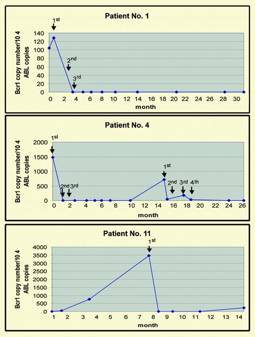 Results of Rt-Q-PCR studies from 3 patients during the therapy with GO. See the complete figure in the article beginning on page 1995.