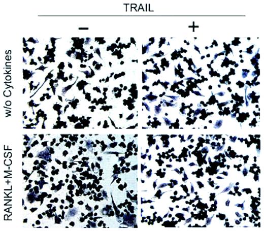 Effect of TRAIL on differentiation of RAW264.7 cells into functional osteoclasts. See the complete figure in the article beginning on page 2044.